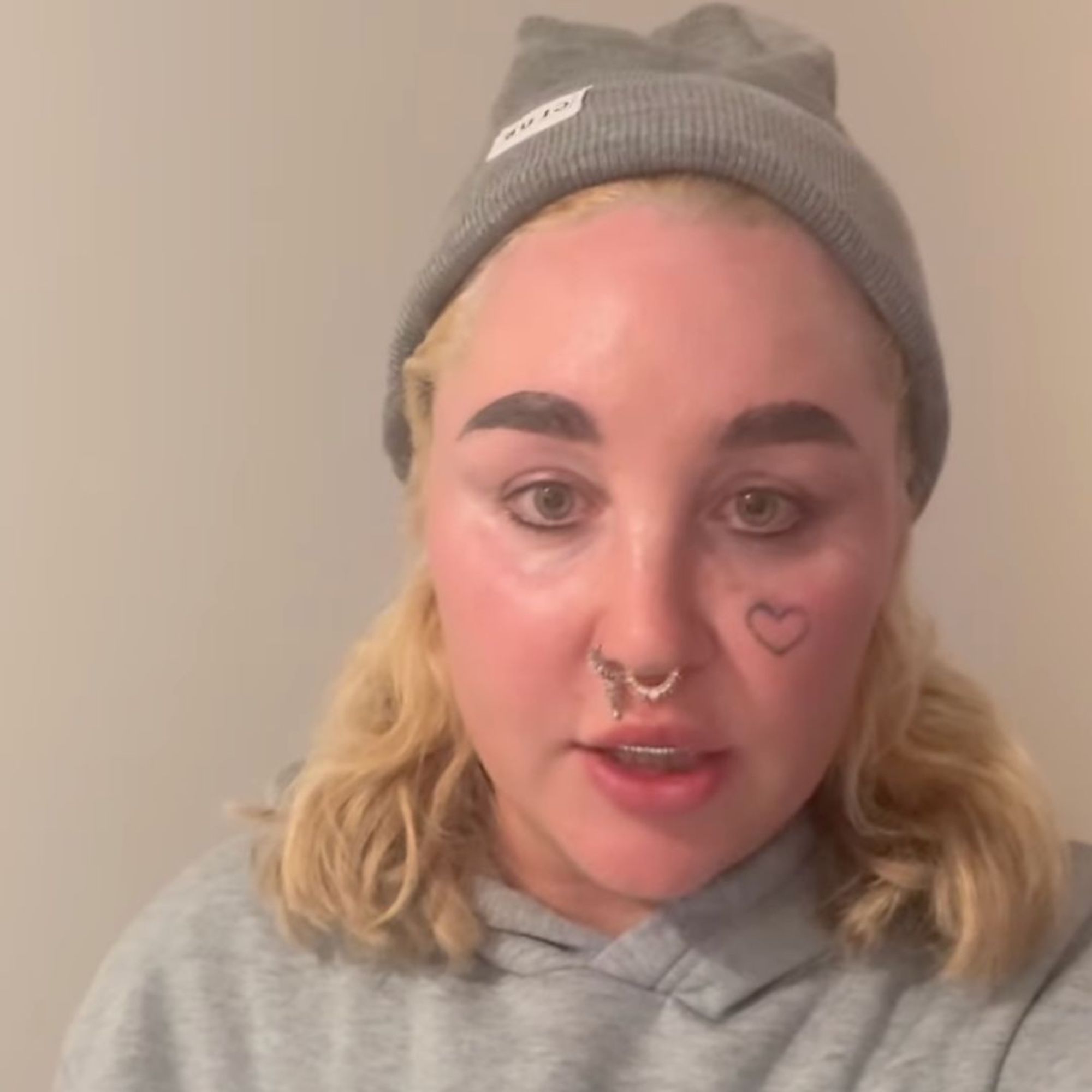 Amanda Bynes Explains Why She Can't Wear Tooth Gems