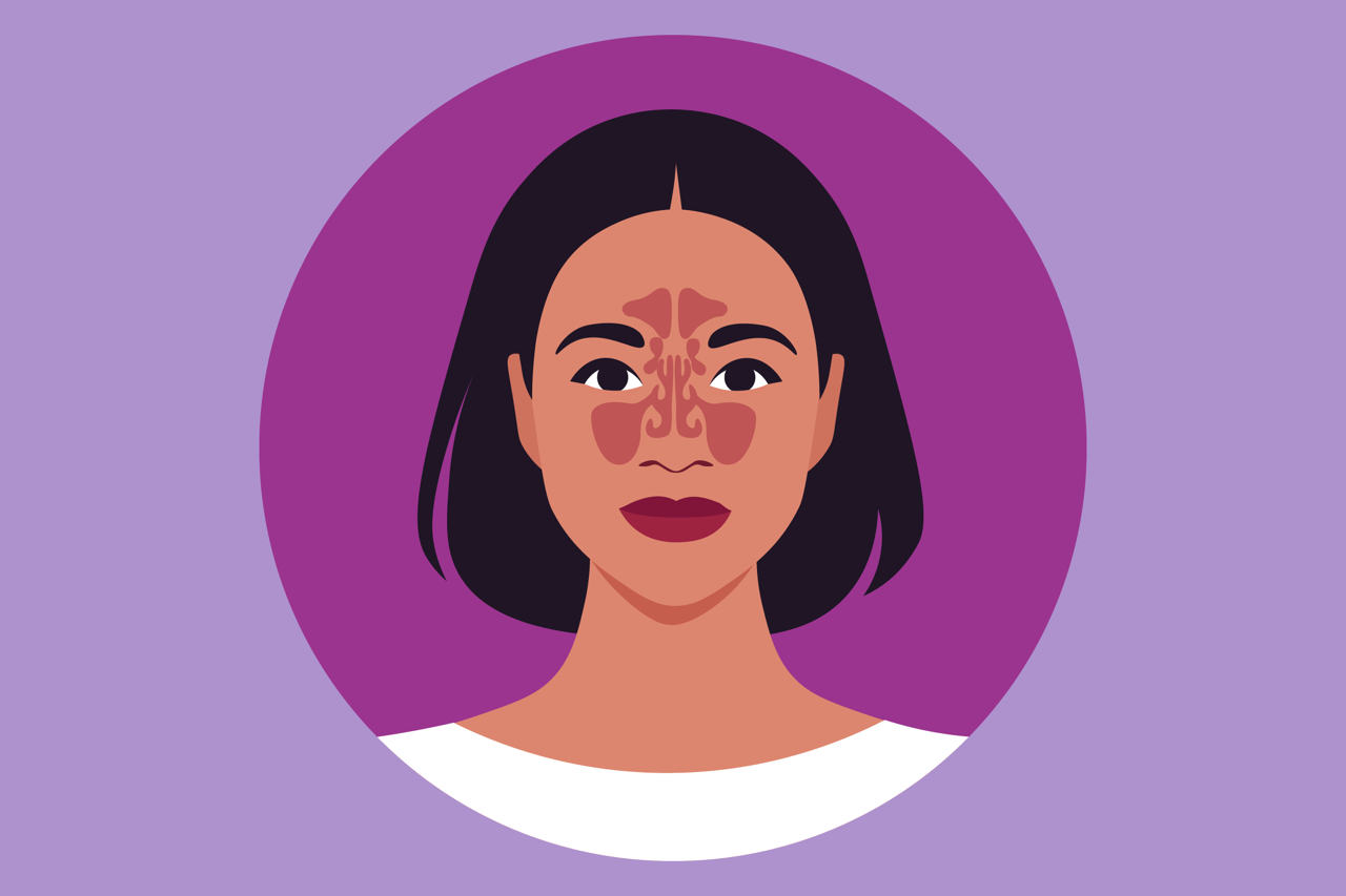 Navigating Health Insurance for Nasal Polyps